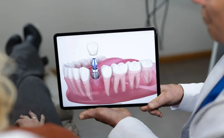 Dental Implants: A Long-Lasting Solution for Missing Teeth in Wauwatosa